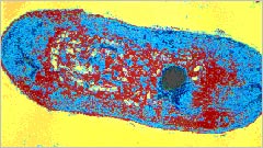 туберкулезная палочка, палочка Коха под электронным микроскопом палочка Коха