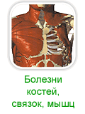 Симптомы и лечение заболеваний костей и мышц народными средствами