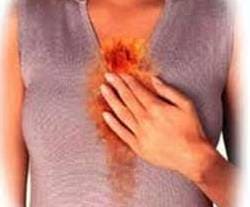 Изжога при беременности - Причины, симптомы и лечение