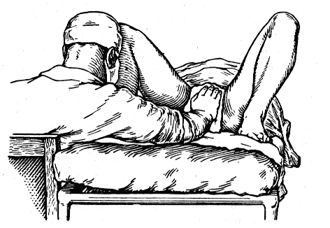 Роды в тазовом предлежании Роды в тазовом предлежании