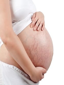 Живот при беременности - Причины, симптомы и лечение