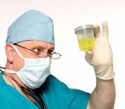 Белок в моче (протеинурия) Белок в моче (протеинурия)