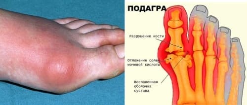 Биохимический анализ крови