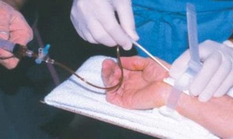 Коронарография