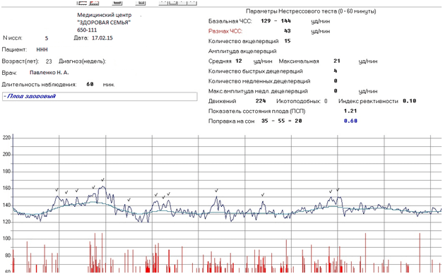 Кардиотокография (КТГ) при беременности