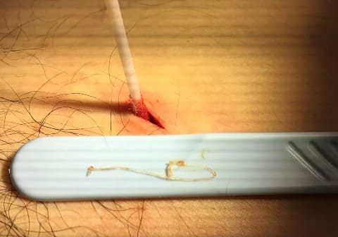 Дирофилярия Дирофилярия