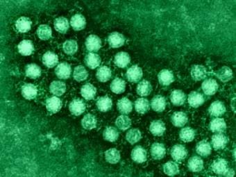 Энтеровирусы Энтеровирусы