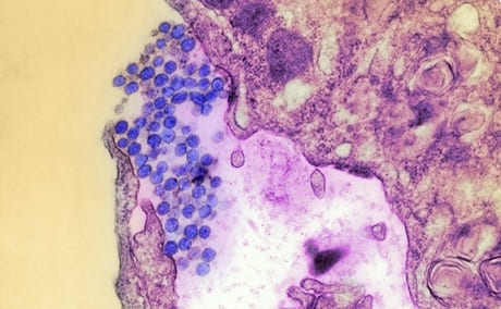 Вирус Хантаан - возбудитель ГЛПС