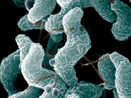 Возбудитель кампилобактериоза Возбудитель кампилобактериоза