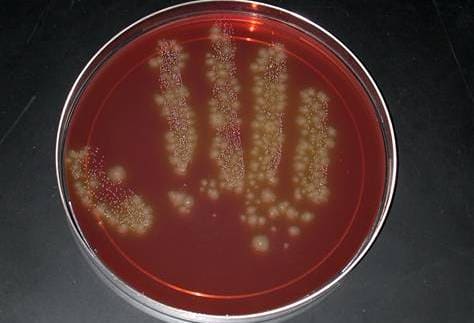 Клостридии при бакпосеве