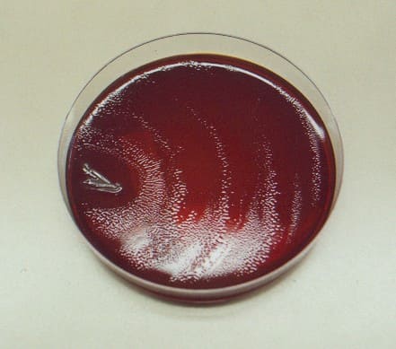 Протей на питательной среде