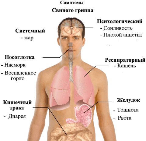 Симптомы свиного гриппа