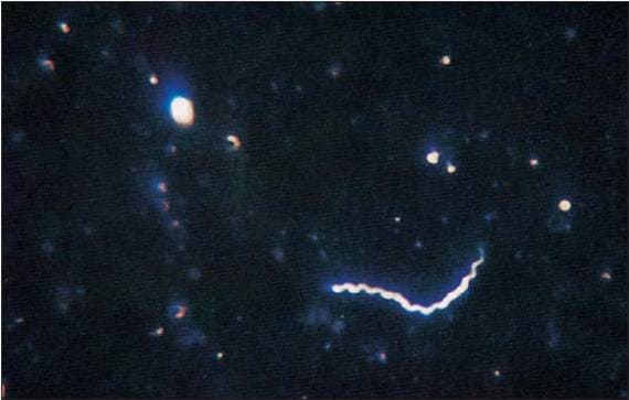 Трепонема (спирохета) под микроскопом Трепонема (спирохета) под микроскопом