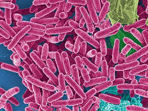 Синегнойная палочка