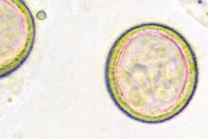 Онкосферы бычьего цепня