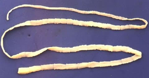 Тениоз (свиной цепень)