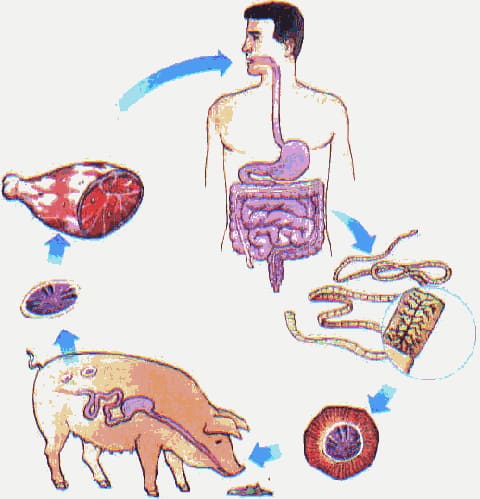 Тениоз (свиной цепень)