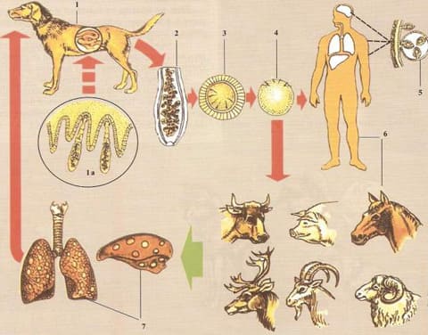 Трихинеллез