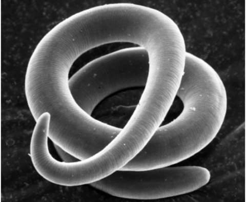 Трихинелла