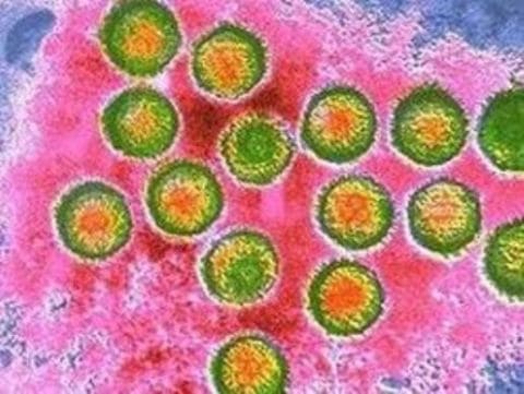 Вирус Эпштейн-Барр