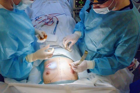 Увеличение груди