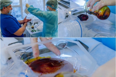 Увеличение груди