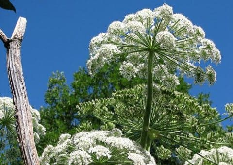 Ожоги от борщевика Ожоги от борщевика