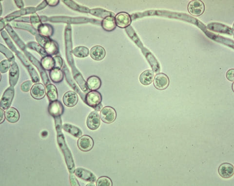 Грибок (кандида) под микроскопом Грибок (кандида) под микроскопом