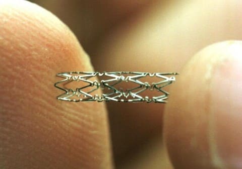 Коронарная баллонная ангиопластика Коронарная баллонная ангиопластика