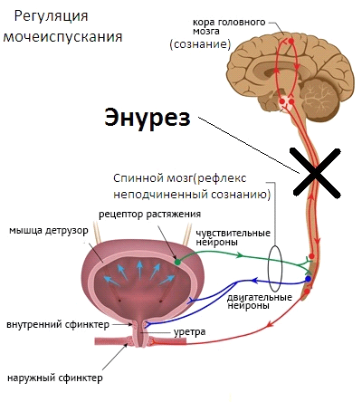 Энурез у детей и взрослых 