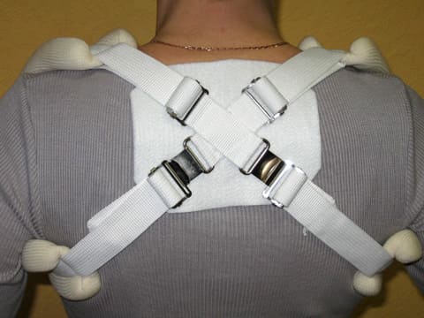 Перелом ключицы