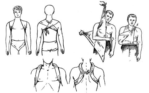 Первая помощь при переломе ключицы