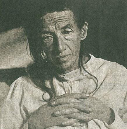 Альцгеймера