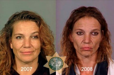 Как меняется человек, становясь наркоманом, зависимым от героина: слева - до приема наркотиков, справа - через год наркомании