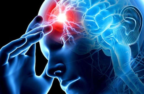 Атеросклероз сосудов головного мозга (церебральный) Атеросклероз сосудов головного мозга (церебральный)