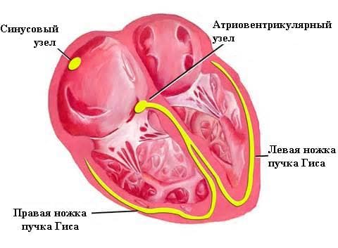 Блокады сердца 