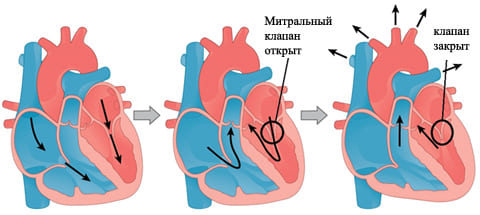 Пролапс митрального клапана что это такое
