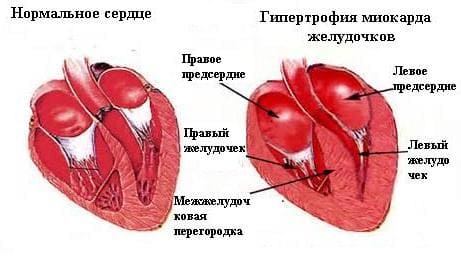 Облысение женщин лечение форум