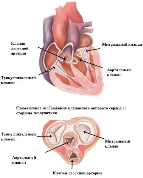 Стеноз митрального клапана (митральный стеноз)