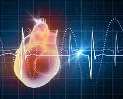 Тахикардия