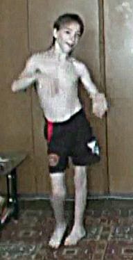 Симптомы детского церебрального паралича ДЦП Симптомы детского церебрального паралича ДЦП