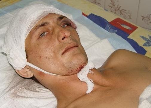 Больной с черепно-мозговой травмой и сотрясением мозга Больной с черепно-мозговой травмой и сотрясением мозга