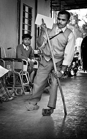 Фото взрослого, перенесшего полиомиелит Фото взрослого, перенесшего полиомиелит