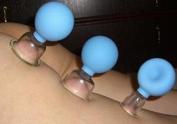 Баночный массаж