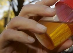 Уринотерапия (лечение мочей)