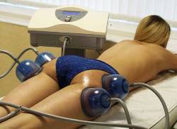 Вакуумный массаж