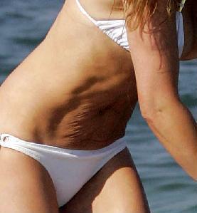 Живот после родов Живот после родов